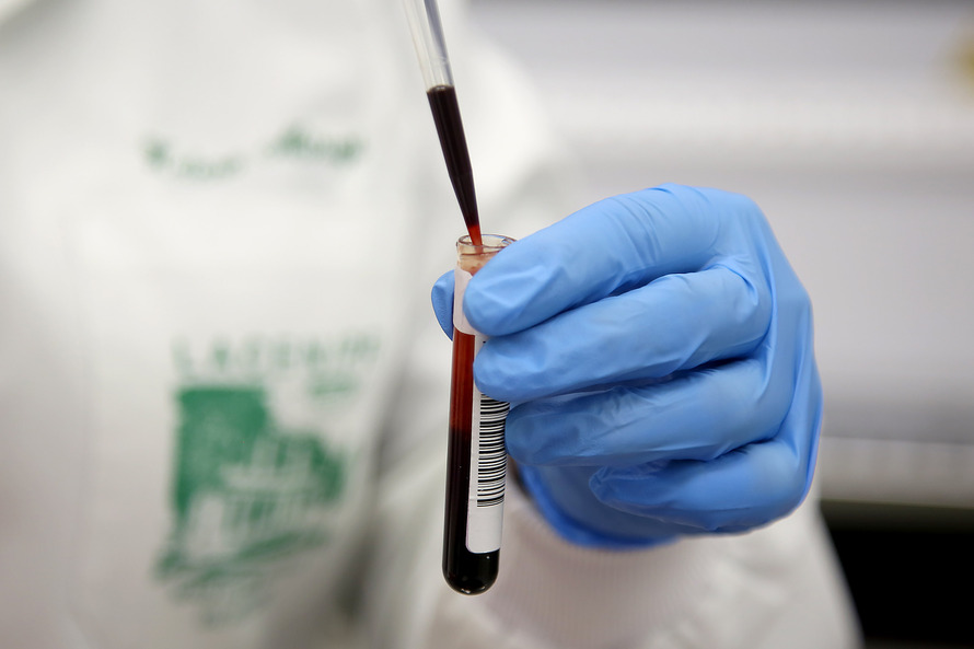Paraná habilita quatro laboratórios para testes de coronavírus